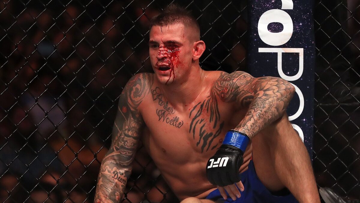 Дастин Пуарье не хотел принимать данный бой, так как Эдди Альварес в последних своих поединках дерется довольно "грязно" используя удары в пах, тычки пальцами в глаза и запрещенные удары локтем и коленом.