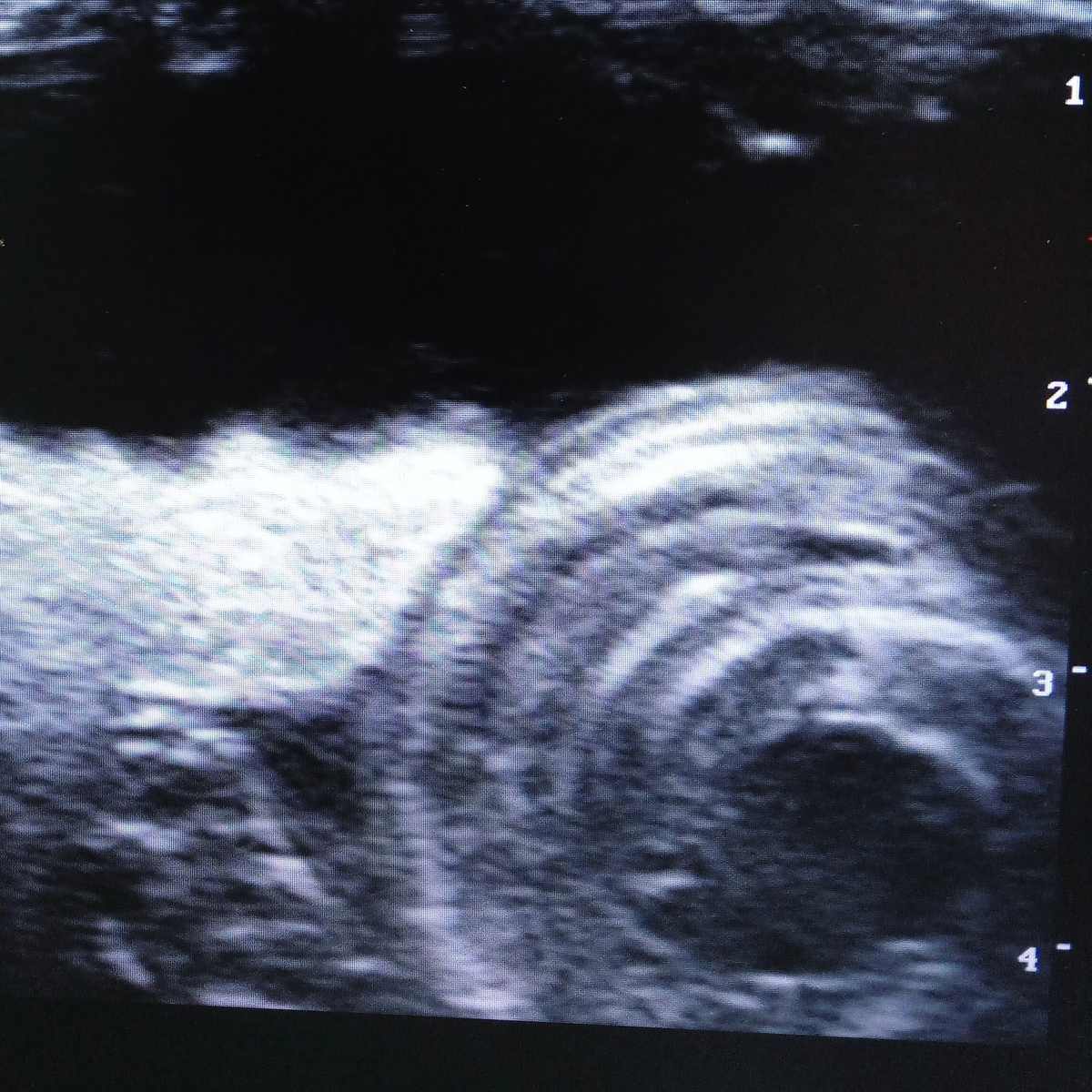 Не каждому ветеринарному врачу удаётся увидеть такие кадры, но нашей коллеге  крупно повезло, на приёме оказалась беременная самка удава обыкновенного. 