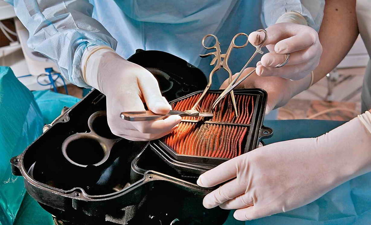 Что будет если не заменить вовремя воздушный фильтр в автомобиле? | Fastmb.ru | Дзен