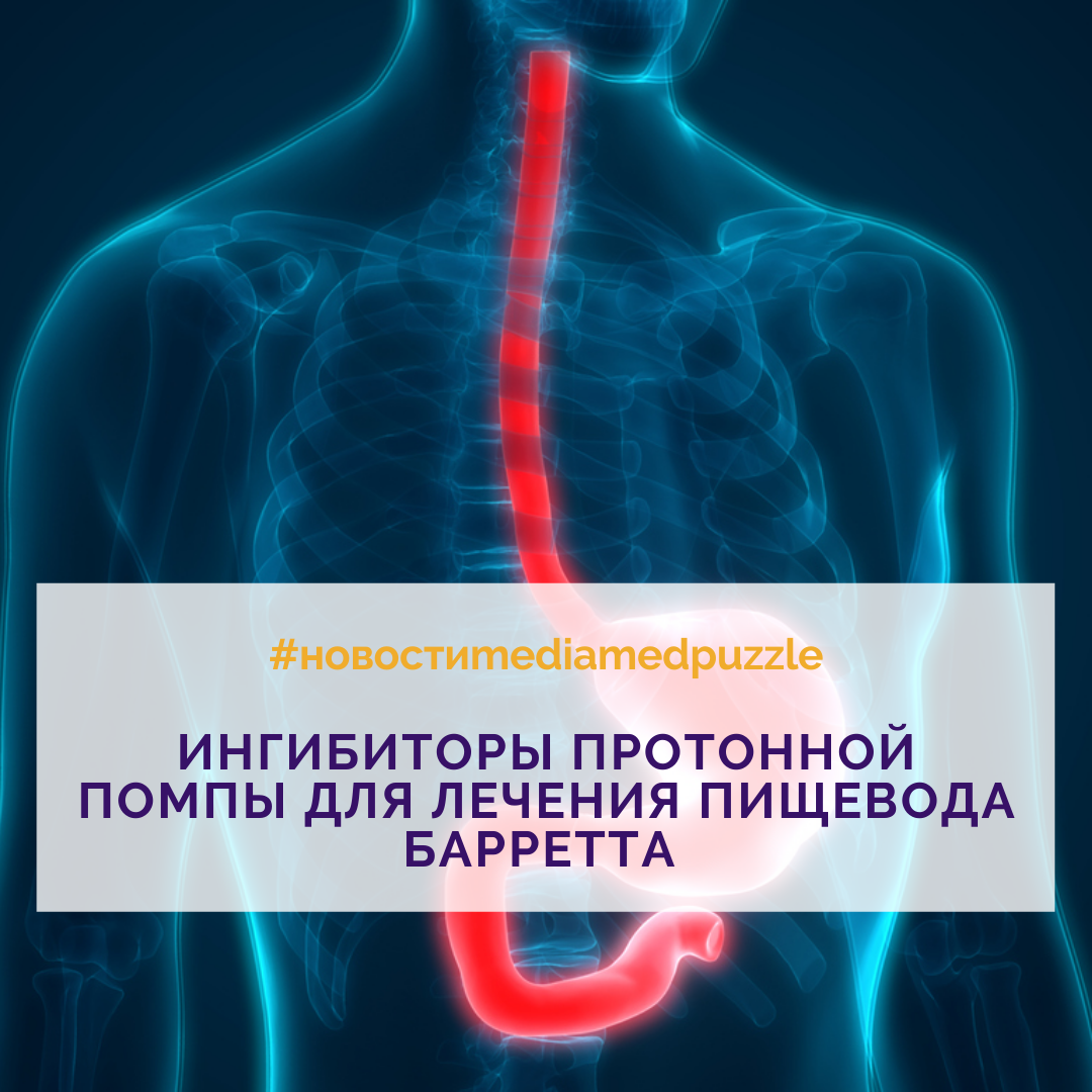 Пищевод какой врач. Ингибиторы протонной помпы. Строение протонной помпы. Блокаторы протонной помпы при пищеводе Баррета.