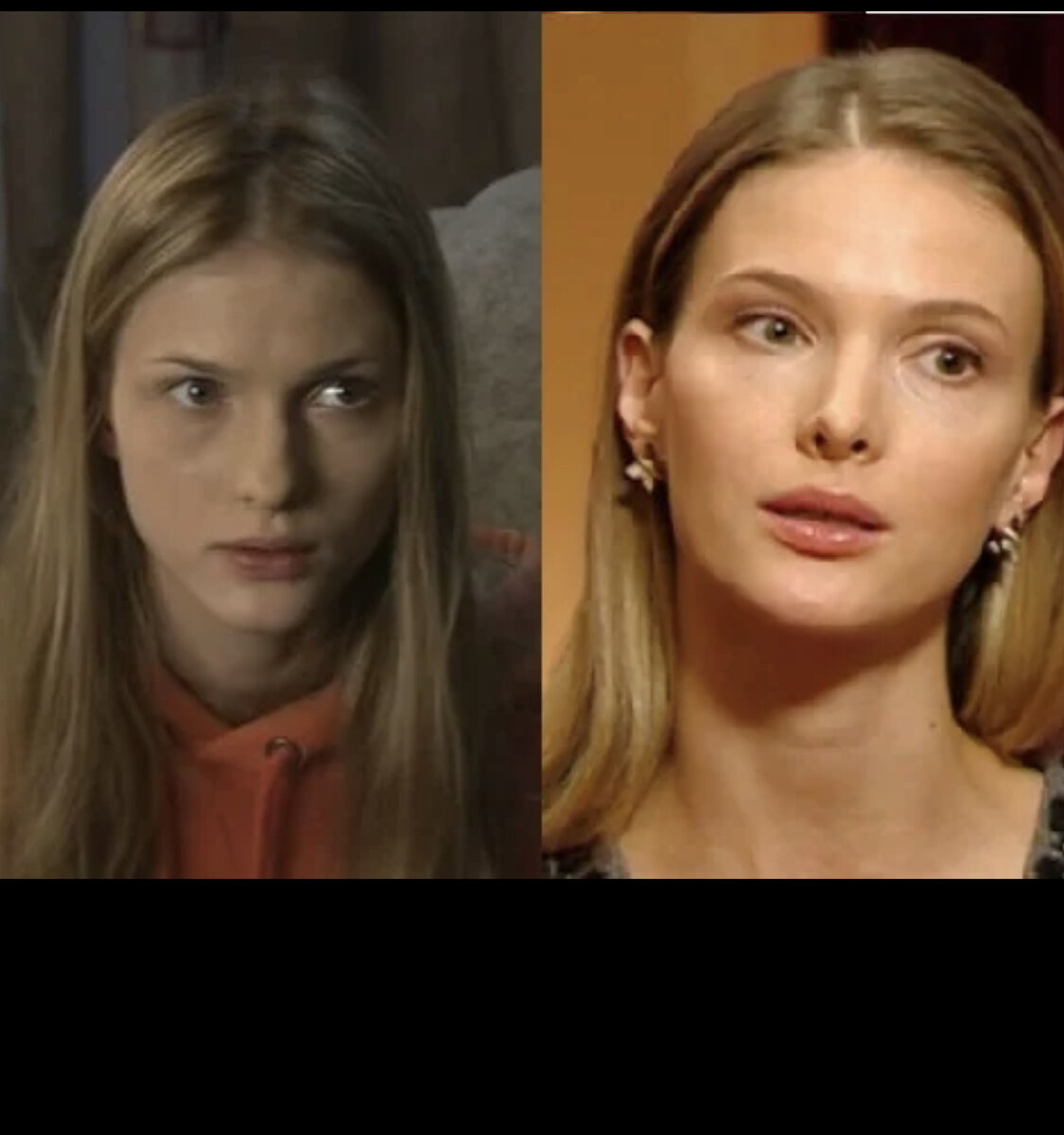 До и После: Молодые российские актрисы, которые уже успели сделать  пластику. Сравниваем фото | Домашний Киновед | Дзен