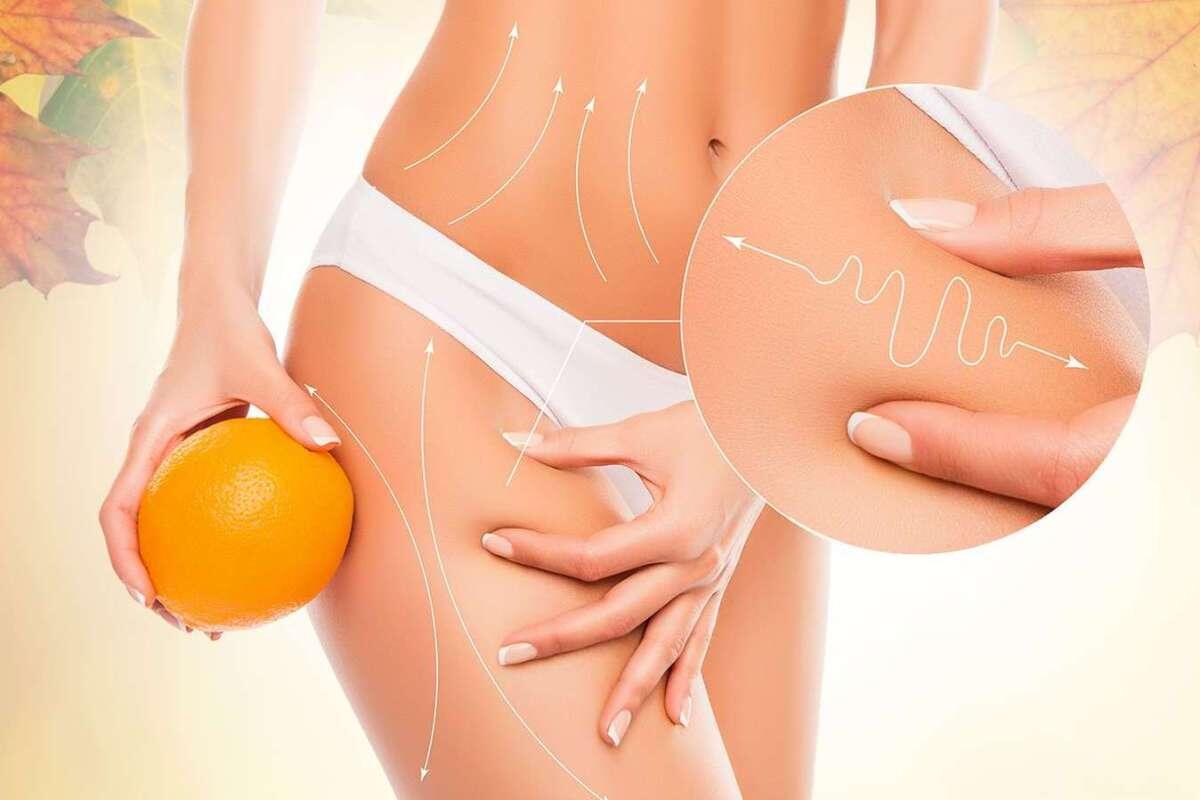 Борьба с целлюлитом