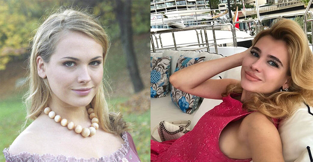 Анна горшкова до и после пластики Анна Горшкова до и после пластики Пластик-Клуб - все о пластике Дзен