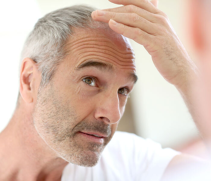 Мужчины лысеют и у них выпадают волосы чаще, чем у женщин. Источник изображения: eighteeneight.com