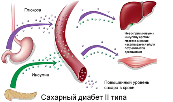 фото: http://diabetpeople.ru