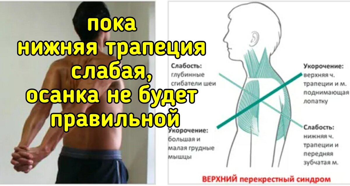 Как исправить осанку — полезные советы и эффективные упражнения