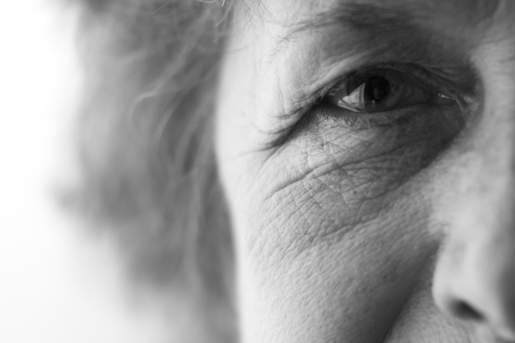 Симптомы инсульта у женщин. Возрастные группы риска