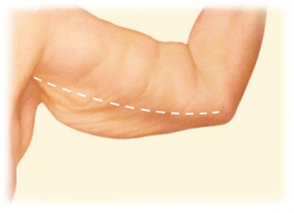 Изменения кожи рук с возрастом