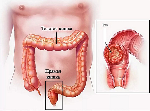 https://www.k31.ru/uploads/content/3/288242f6b3-2.jpg