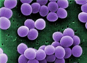 Здоровый человек становится носителем стафилококковой инфекции в горле тогда, когда вдыхает воздух с находящимися в нем бактериями. Если это происходит на фоне (или после) длительного лечения антибиотиками, ослабленной иммунной системы, гормональных нарушений, вирусной инфекции или эндокринного заболевания, развивается воспаление. В горле образуется гнойный налет, мягкие ткани миндалин начинают разрушаться и отмирают, может развиться тонзиллит и другие заболевания. Если врач диагностирует стафилококк горла, лечение нужно проводить не только антибиотиками, но и другими таблетками. Также нужно учитывать, что микроб может быть устойчив к препаратам, которые пациент принимал ранее.