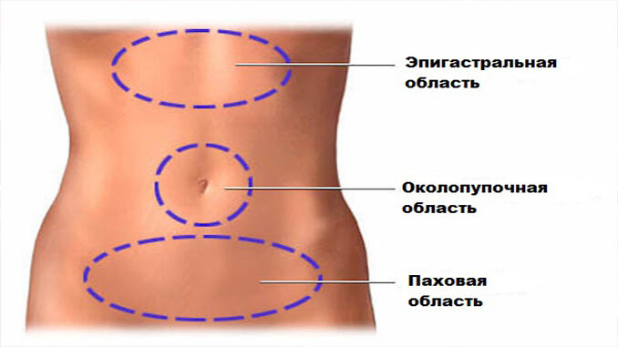 Несварение желудка (диспепсия)