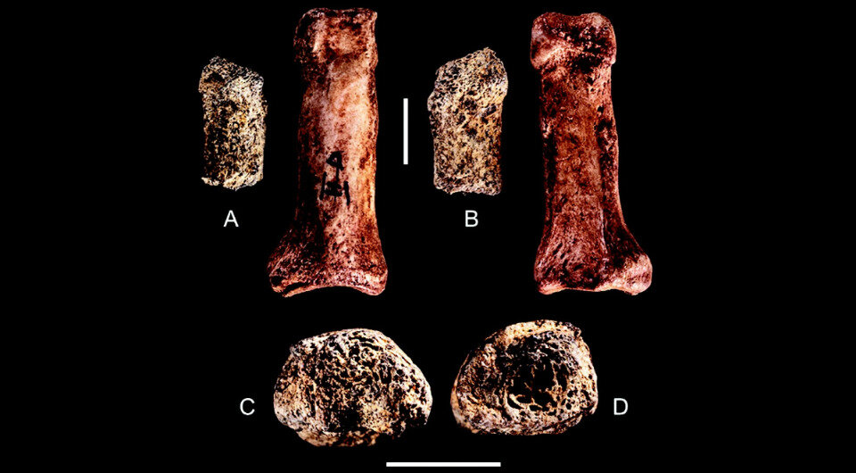   Maria Dolores Garralda et al. / Journal of Anthropological Sciences, 2023