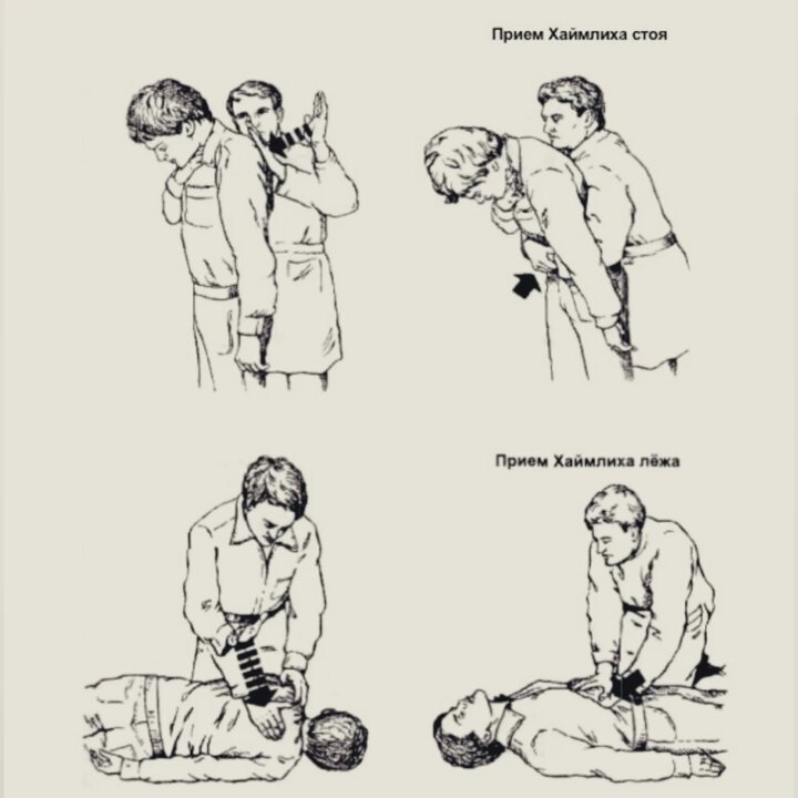 How to perform the Heimlich manoeuvre on yourself (and yes, it's just as effecti