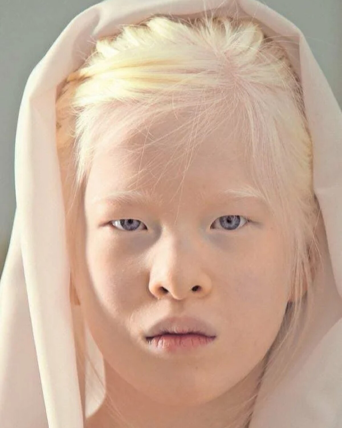 сюэ-ли модель альбинос. глазокожный альбинизм 1 а. альбинос китаянка конни чиу. глазно кожный альбинизм 1 типа. йоханна альбинос.