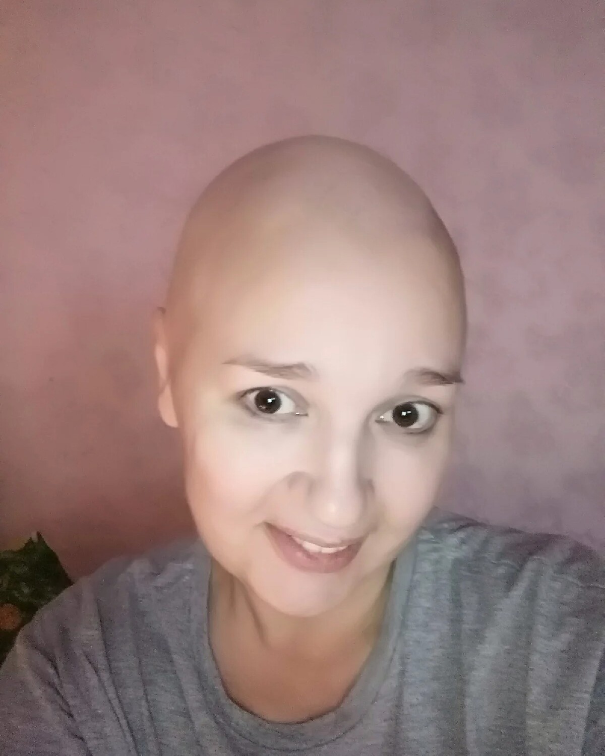 После химиотерапии