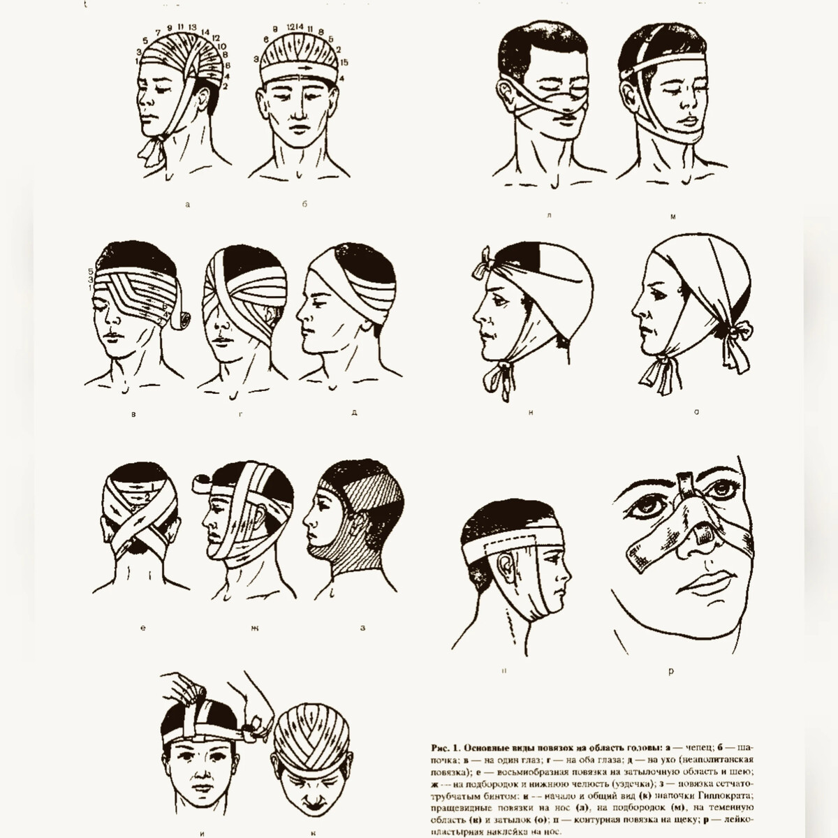 Как перебинтовать голову бинтом схема затылок
