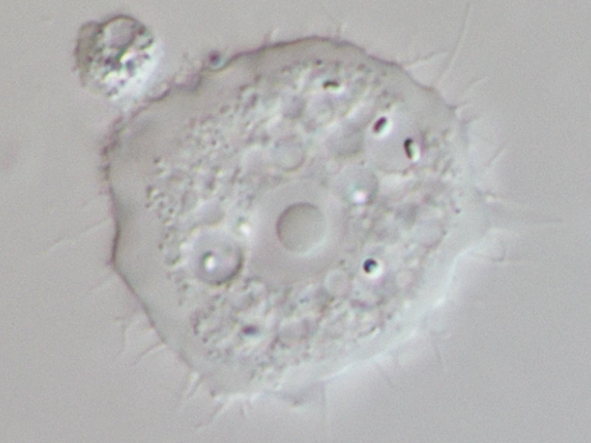 Ниглерии. Амёбы Acanthamoeba.. Acanthamoeba Castellani жизненный цикл. Acanthamoeba Astronyxis жизненный цикл.